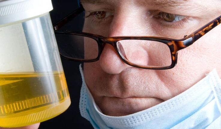 analýza moči na chronickou prostatitidu